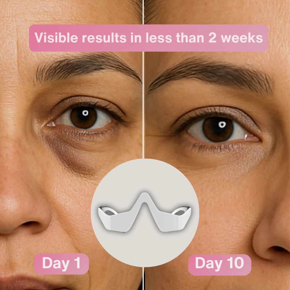 3D Under Eye Mask