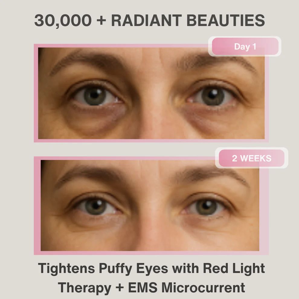 3D Under Eye Mask