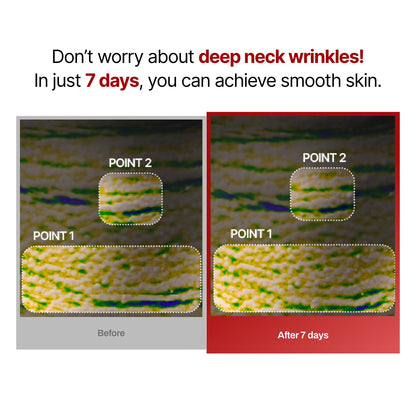 Wrinkle-fit Neck Mask 1 Box (Pack of 7) + Boosting Roller