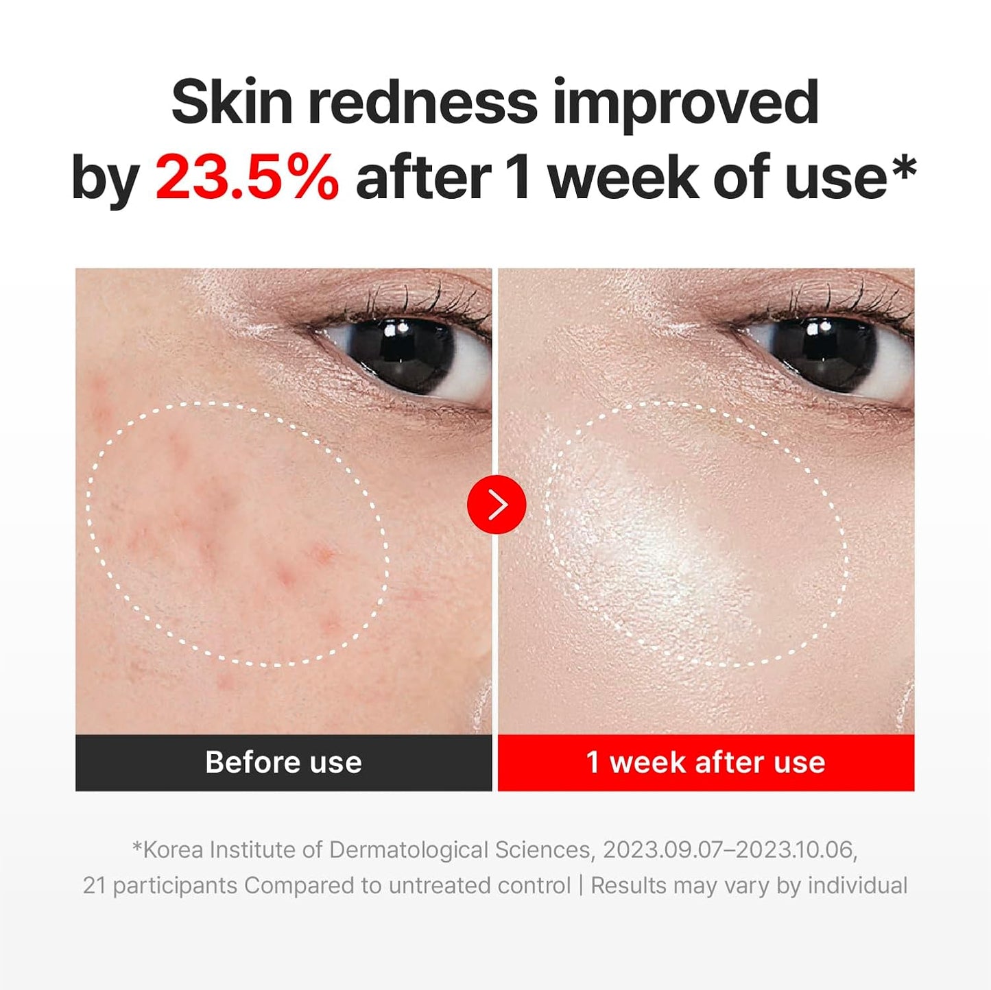 CENTELLIAN 24 Madeca Cream Time Reverse (1.69fl oz)